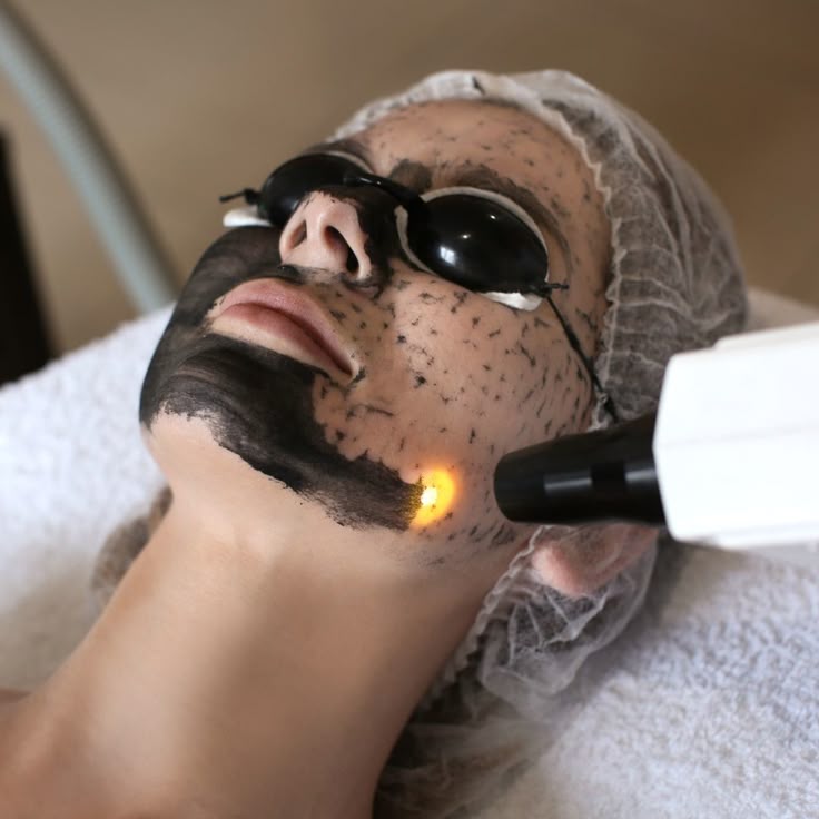 Carbon Laser